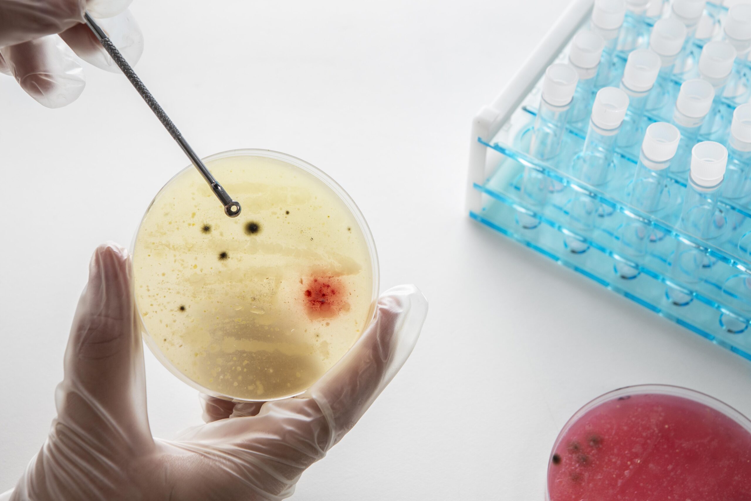 Microbial Analysis sterile lab testing of petri dish bacterial colonies for research