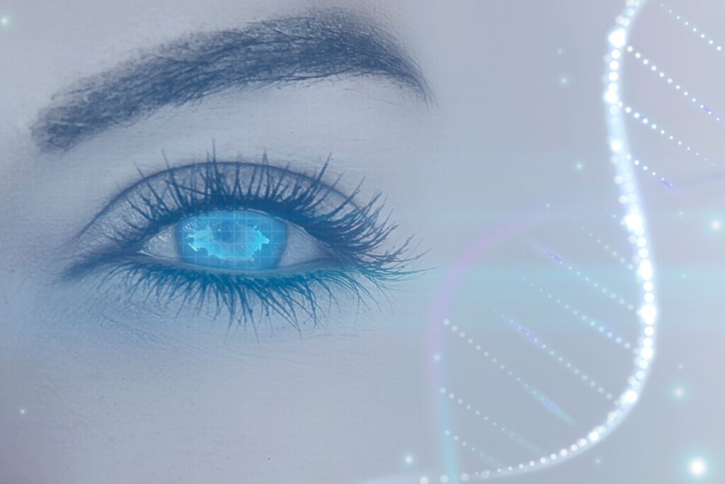 Accurate Genetic Diagnosis in Glaucoma