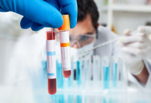 Advanced Biological Sample Preservation