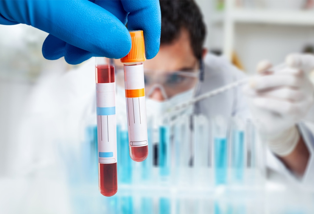 Advanced Biological Sample  Preservation