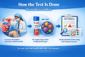 How the Test Is Done