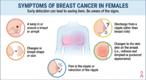 Symptoms of Breast Cancer in Females